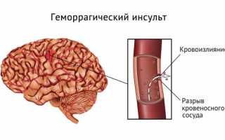 Что такое таламус? Значение зрительного бугра в функционировании нервной системы человека