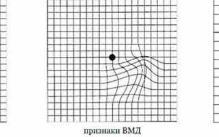 Курзанцева О.М. • Комплексное УЗИ очаговых образований щитовидной железы (методика ЦДК)